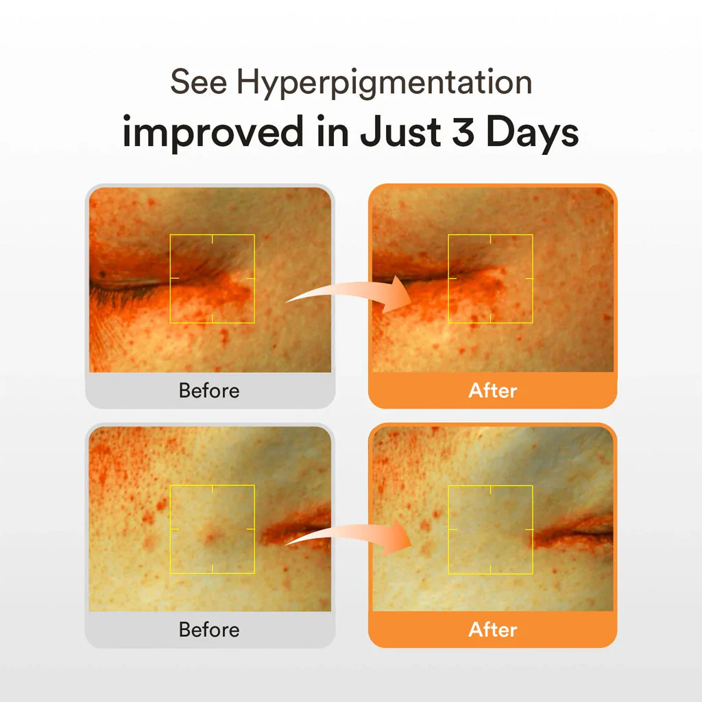 Glutathiosome Dark Spot Serum Vita Drop (50ml) - Image 2