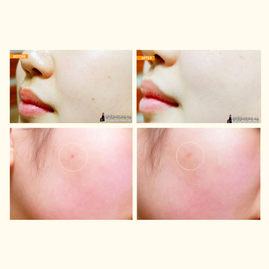 Spot Eraser - Image 3
