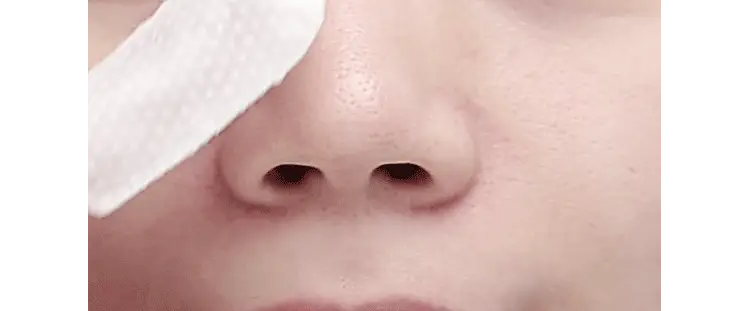 Goblin Blackhead Peeling Pad - Image 2