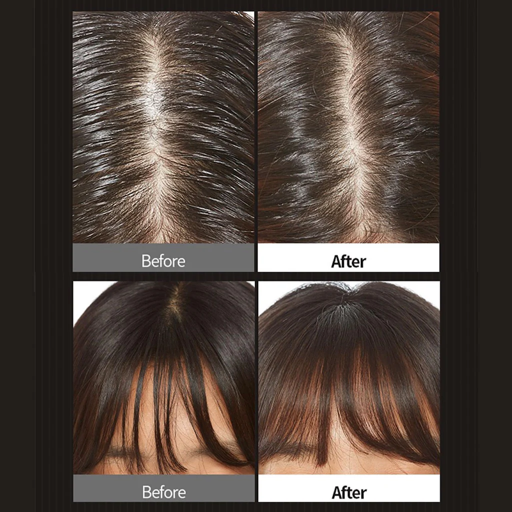 Oily Hair Dry Powder - Image 2
