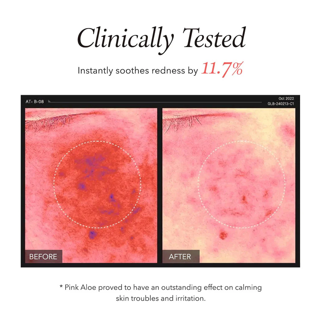 Pink Aloe Pack Cleanser (120g) - Image 3