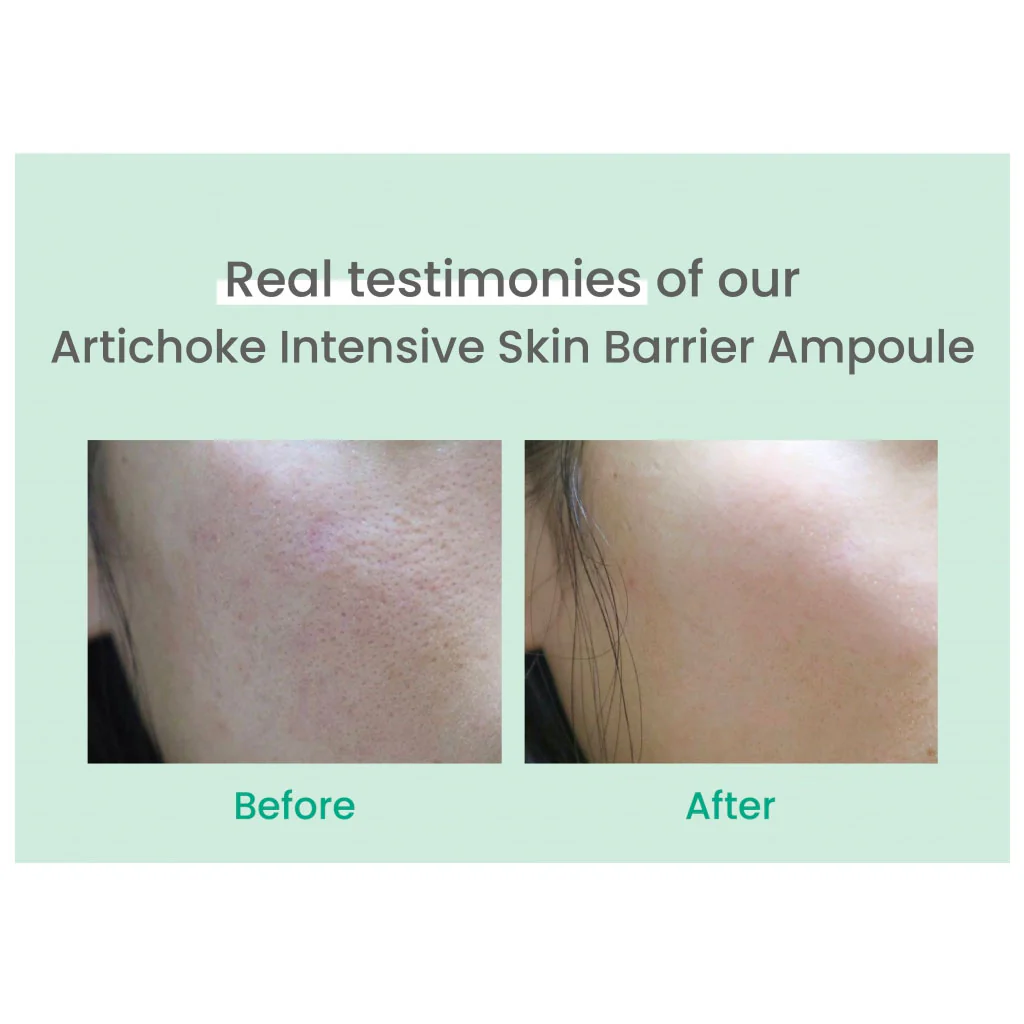 Artichoke Intensive Skin Barrier Ampoule - Image 3