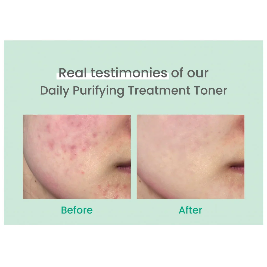 Daily Purifying Treatment Toner - Image 3
