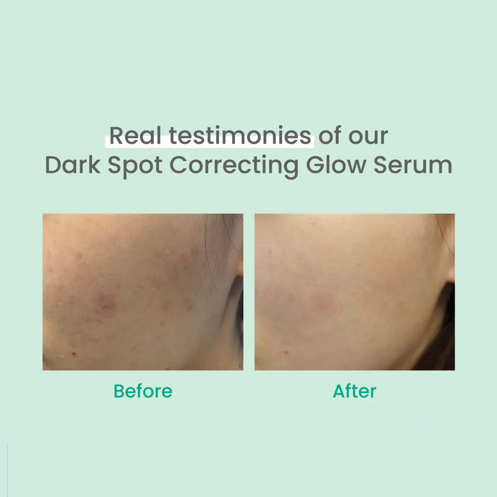 Dark Spot Correcting Glow Serum - Image 3
