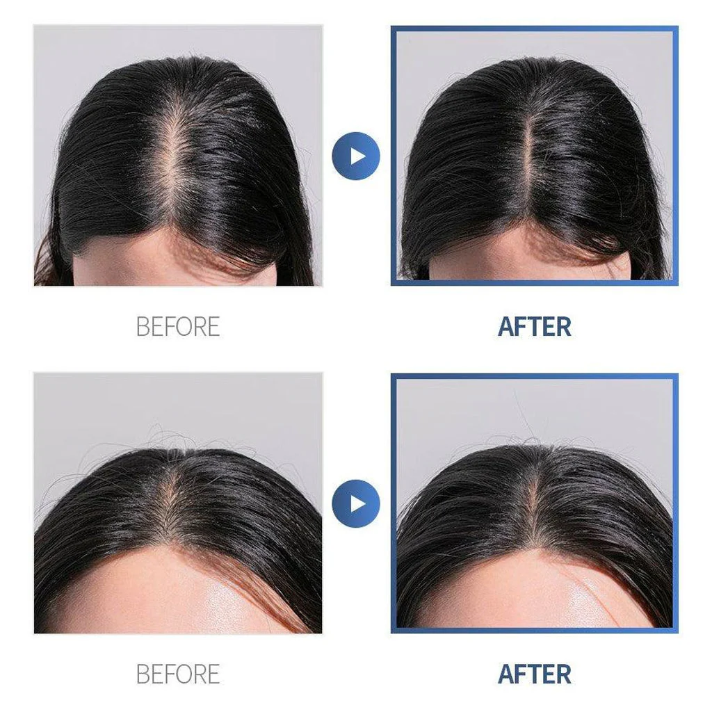 Honest Scalp Nourishing Tonic Ampoule - Image 3