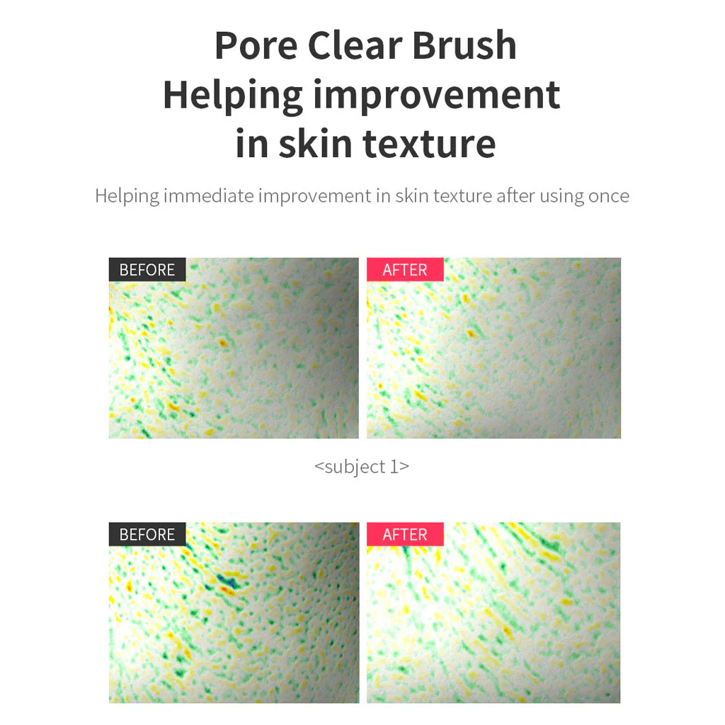 Pore Clear Brush - Image 5