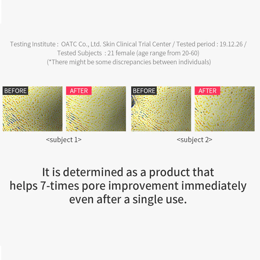Pore Clear Brush - Image 6