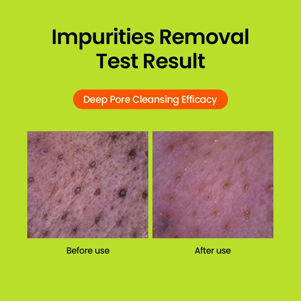 Mung Bean pH-balanced Cleansing Foam - Image 4