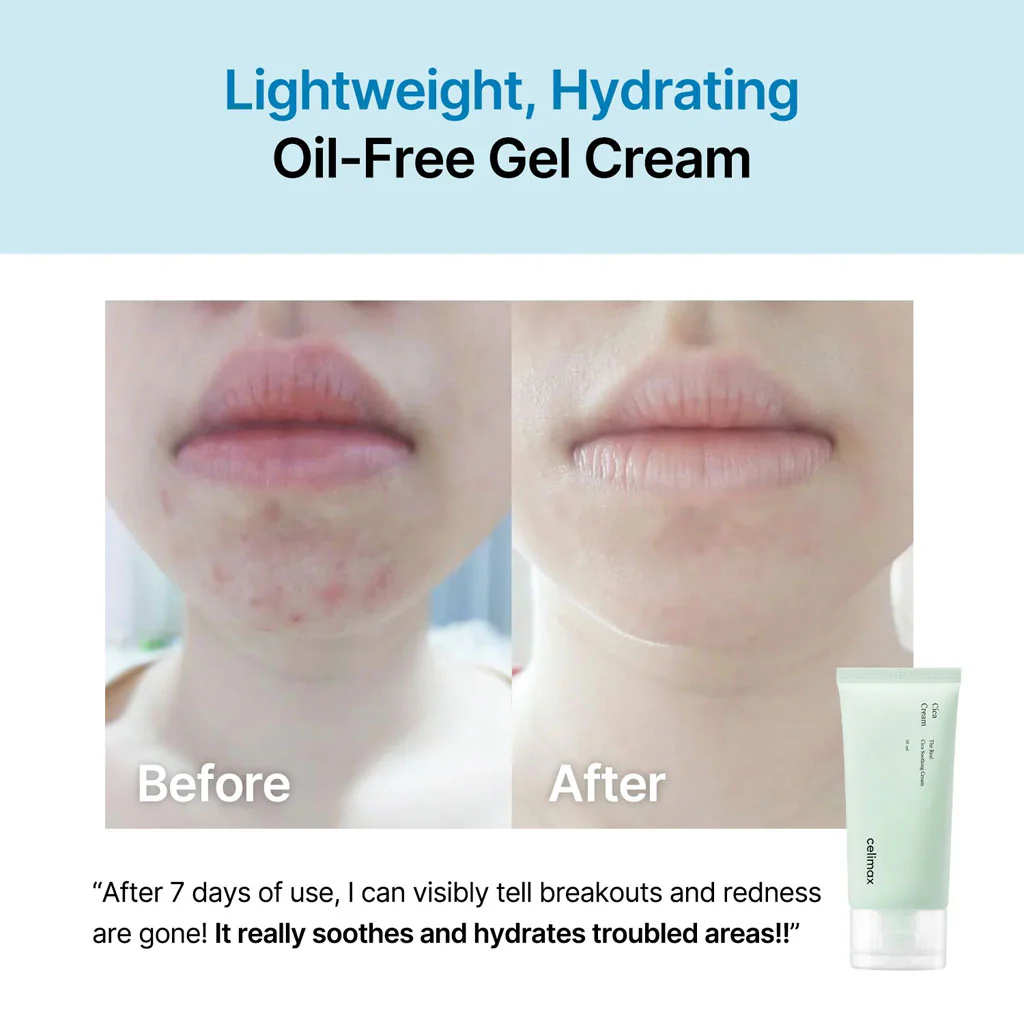 The Real Cica Soothing Cream - Image 3