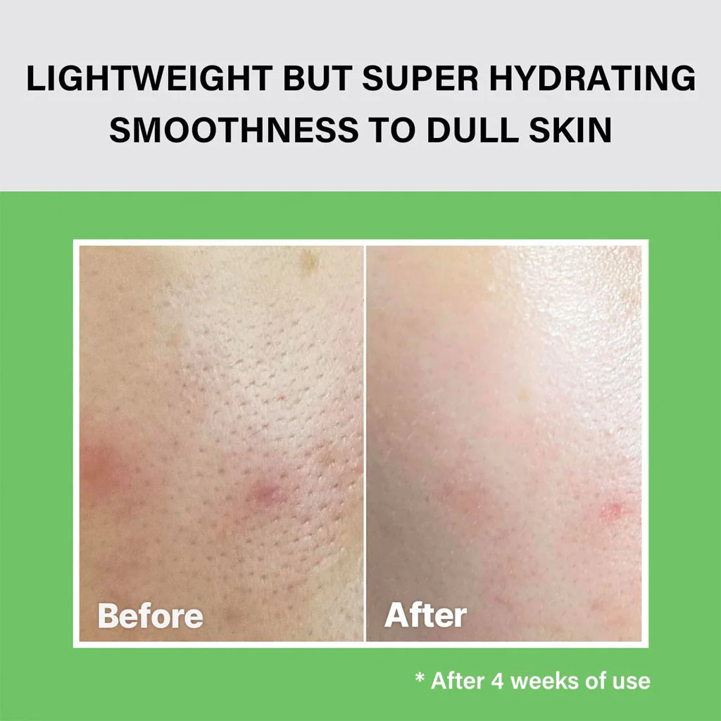 The Real Noni Moisture Balancing Toner - Image 2