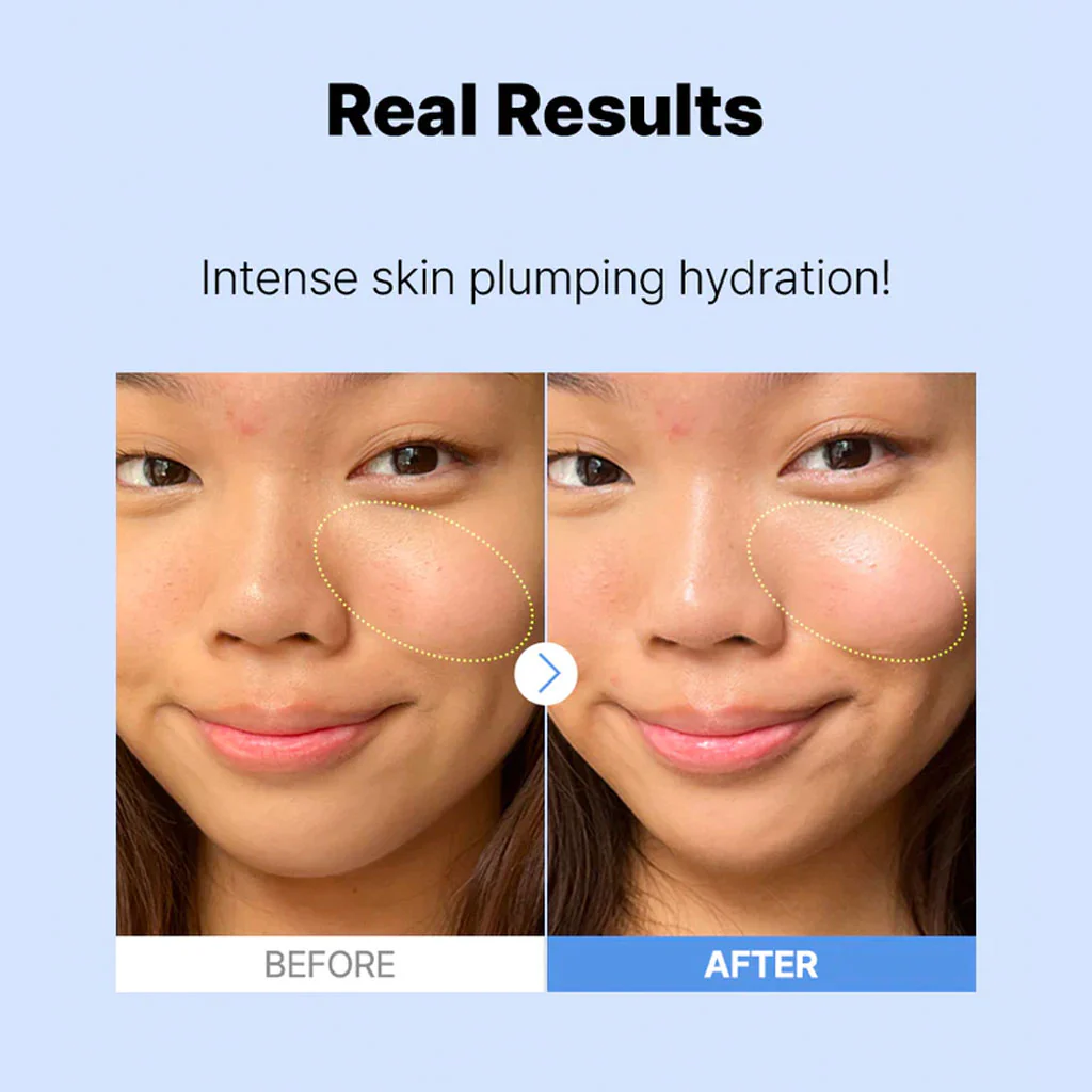 The Hyaluronic Acid 3 Serum (20ml) - Image 2
