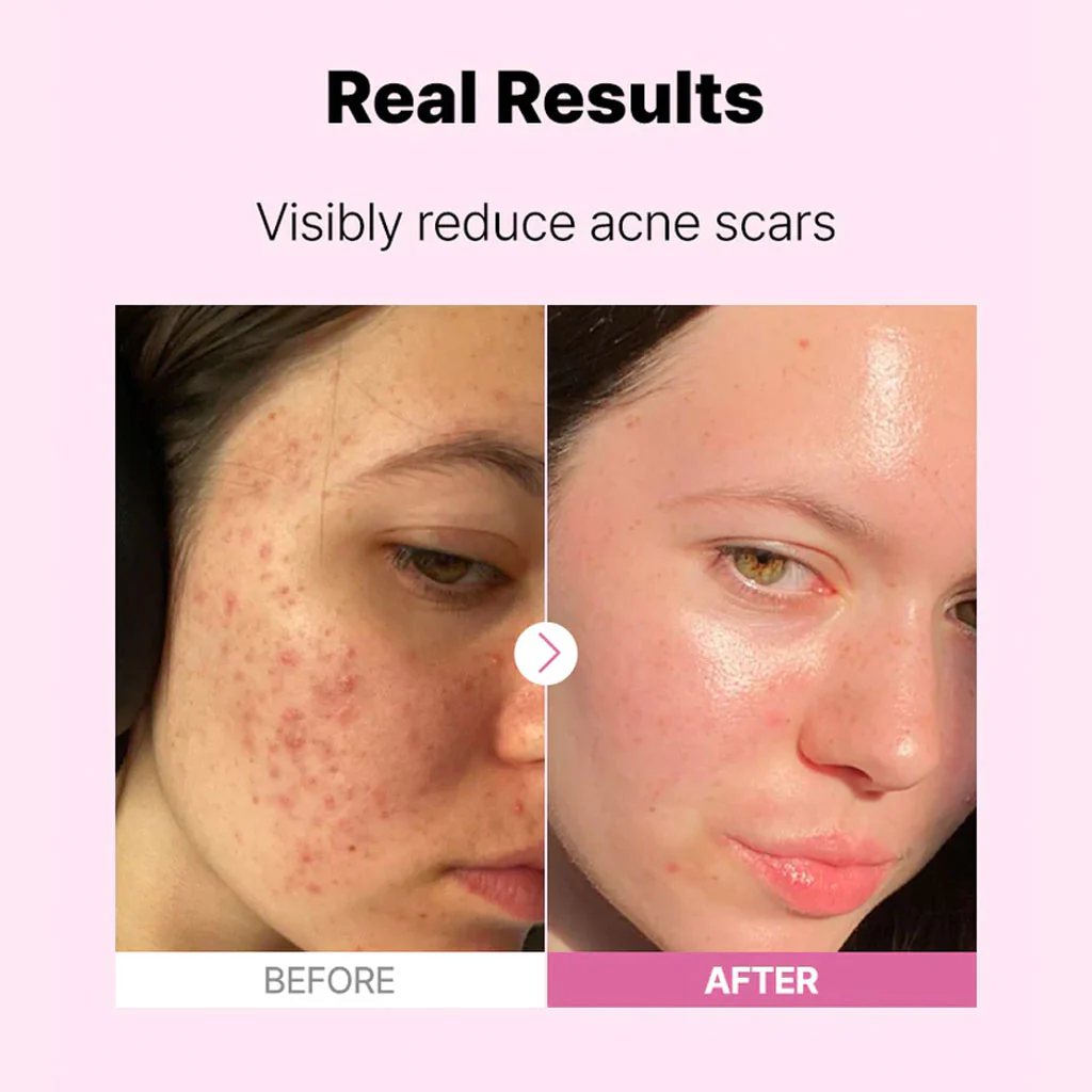 The Niacinamide 15 Serum (20ml) - Image 2
