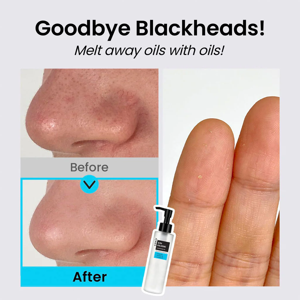 Ultra Hyaluronic Cleansing Oil - Image 2