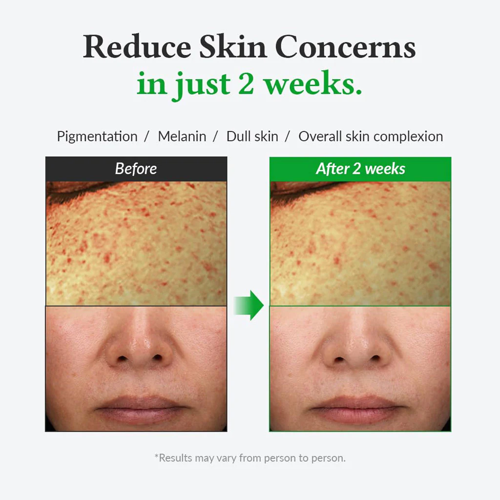 Gentle Vitamin C Serum (30ml) - Image 3