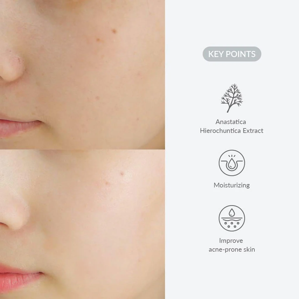 Last Minute Skin Rescue Anastatica Mask - Image 3