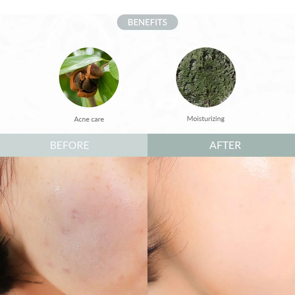 Last Minute Skin Rescue Anastatica Mask - Image 4