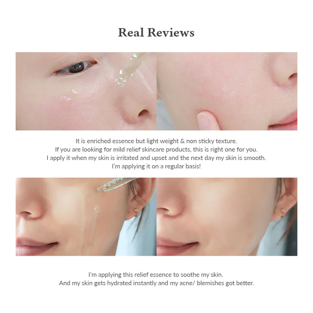 Skin Relief Essence (30ml) - Image 3