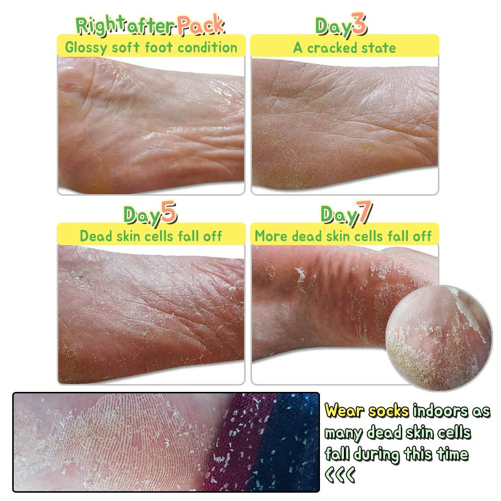 Witch Piggy Hell-Pore Turtle Foot Pack (1pair) - Image 2