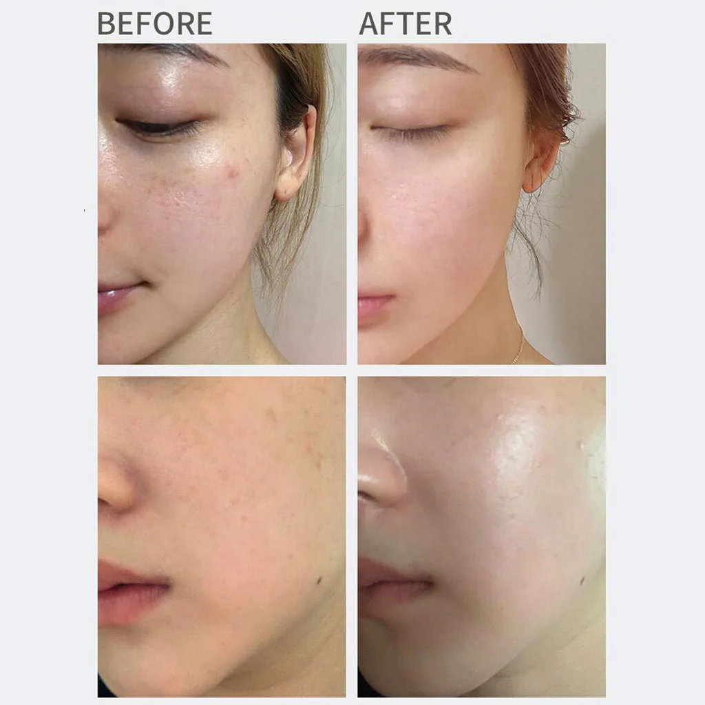 All Clean Vitamin Blemish Spot Clear Cream - Image 3
