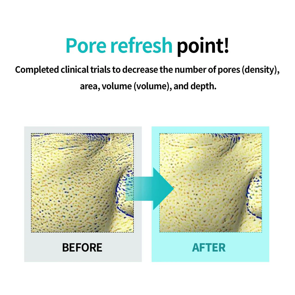 Moringa Tightening Pore Serum (30ml) - Image 2