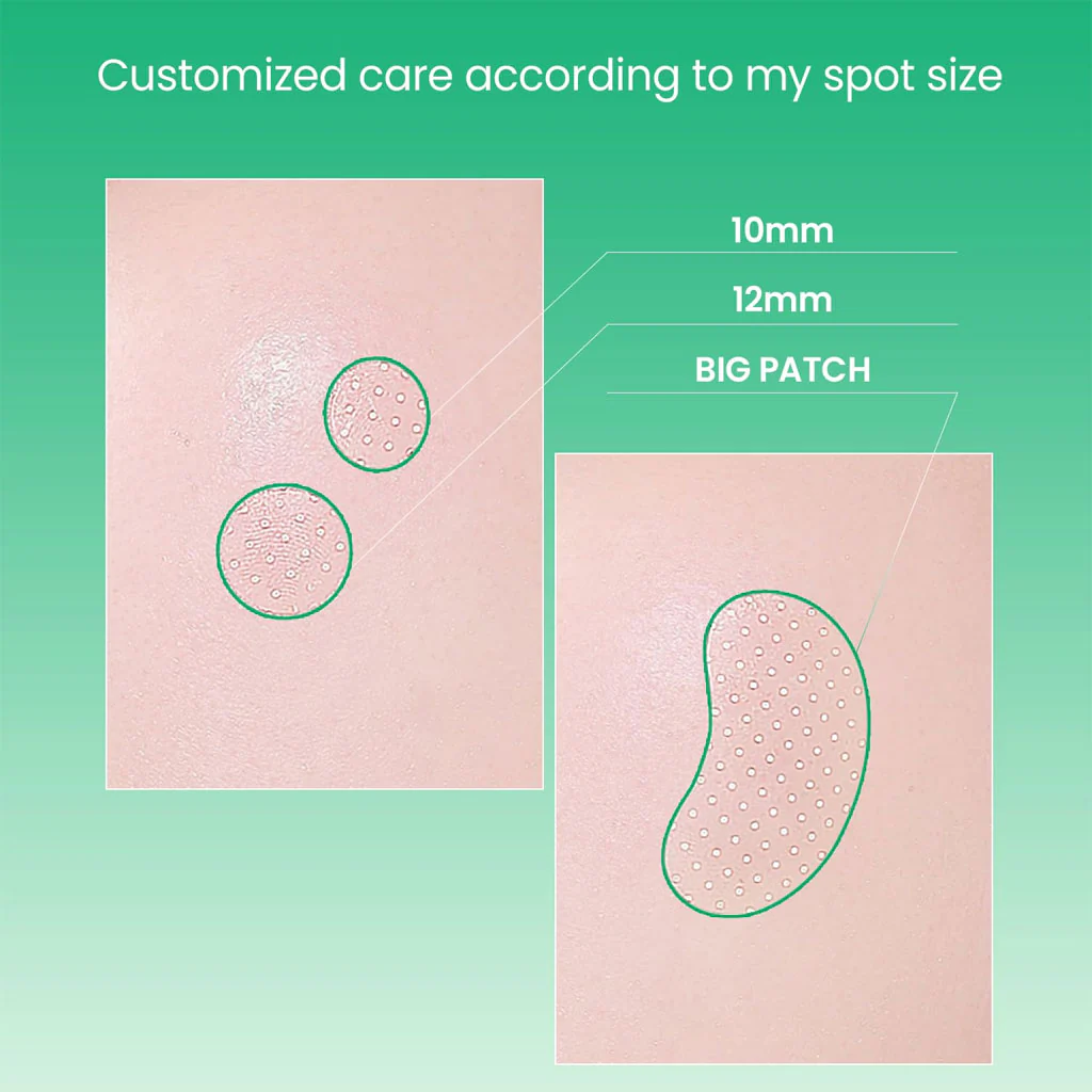 No Problem Spot Patch (72 ea) - Image 2