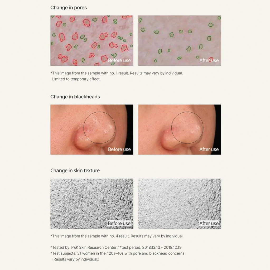Super Volcanic Pore Clay Mask - Image 3