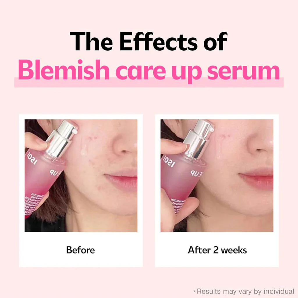 Blemish Care Up Serum - Image 3