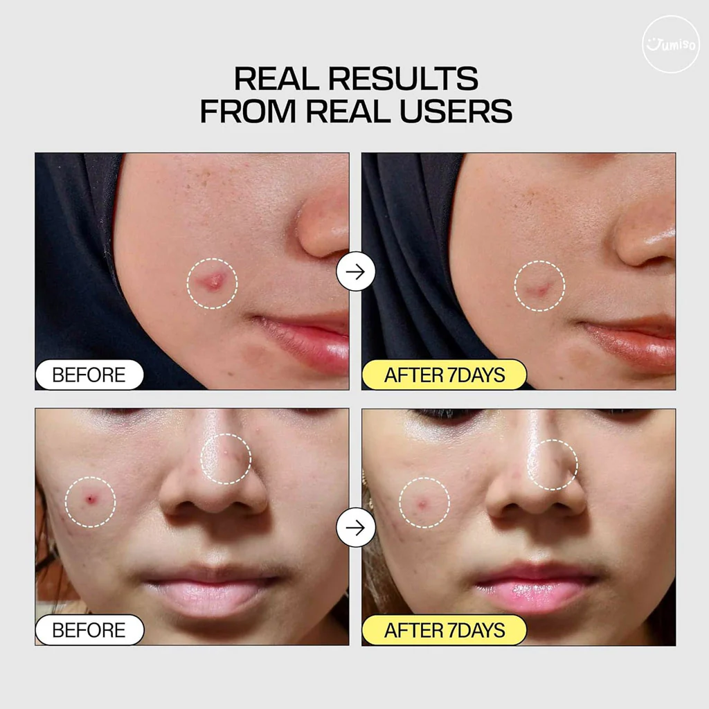 Snail Mucin 95 + Peptide Facial Essence - Image 2