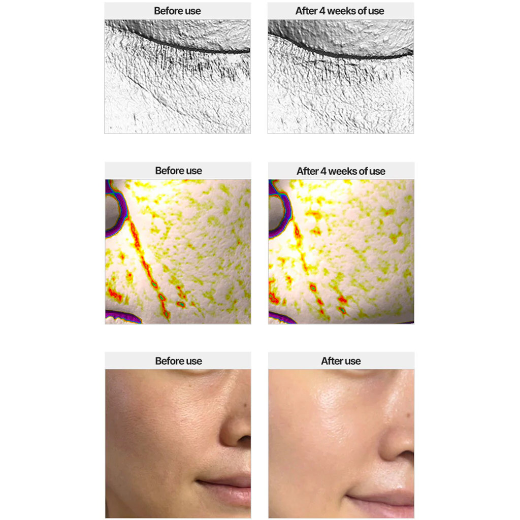 Perfect Renew 3X Serum - Image 3