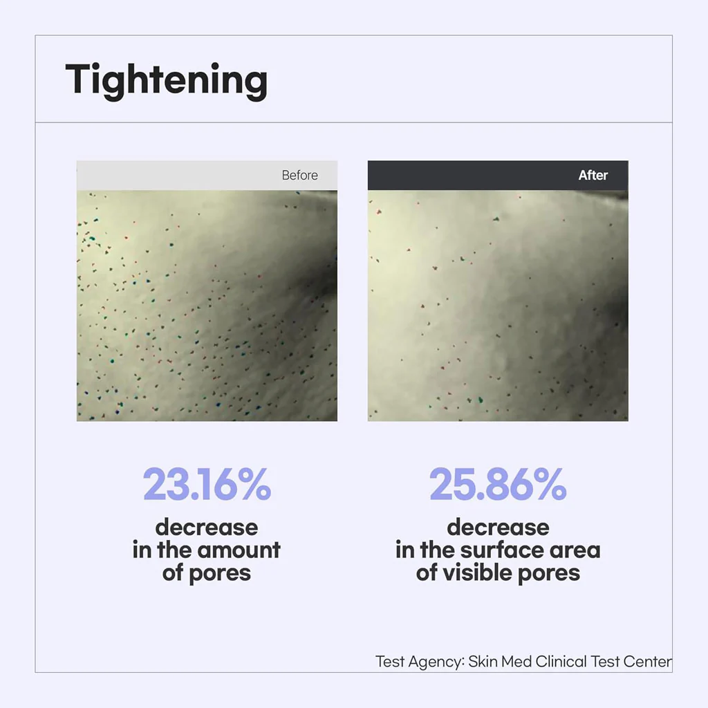Pore Reset Tightening Ampoule (30ml) - Image 3