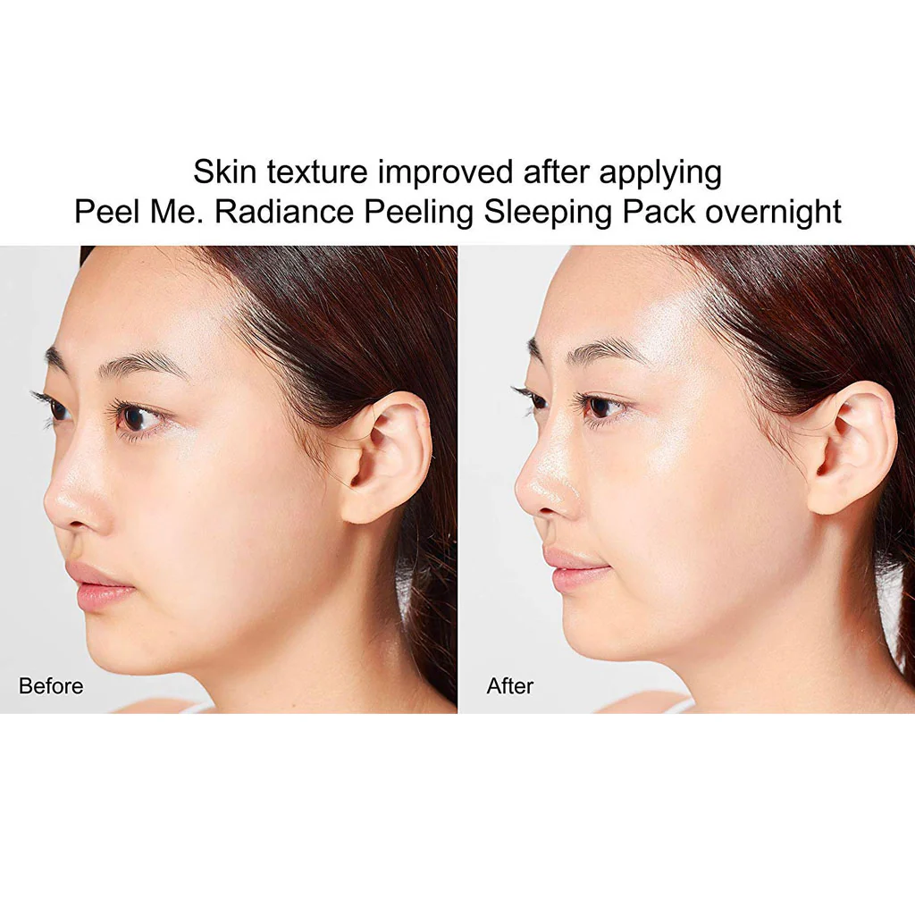 Peel Me. Radiance Peeling Sleeping Pack - Image 3