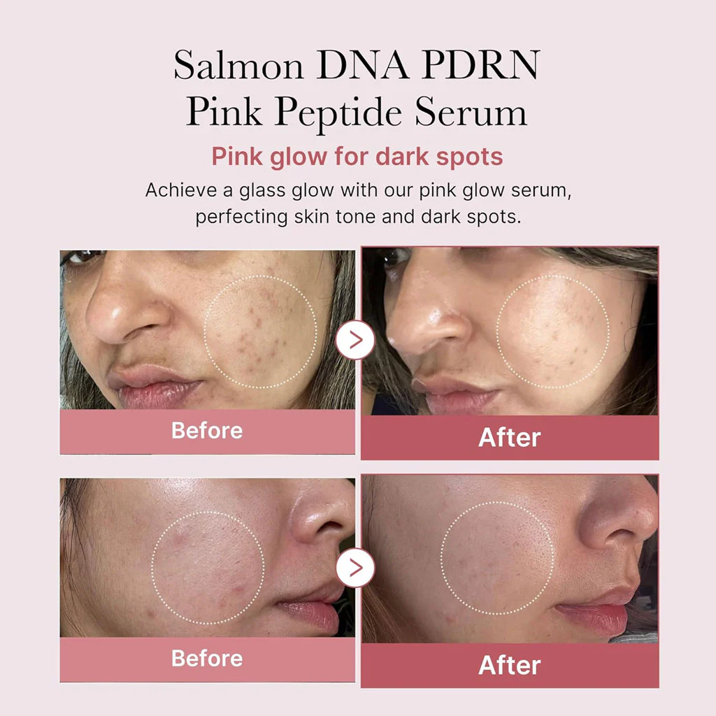 PDRN Pink Peptide Serum (30ml) - Image 2