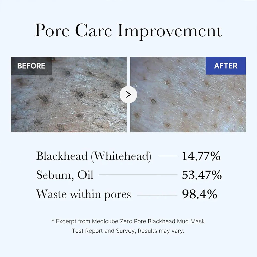 Zero Pore Blackhead Mud Mask (100g) - Image 3