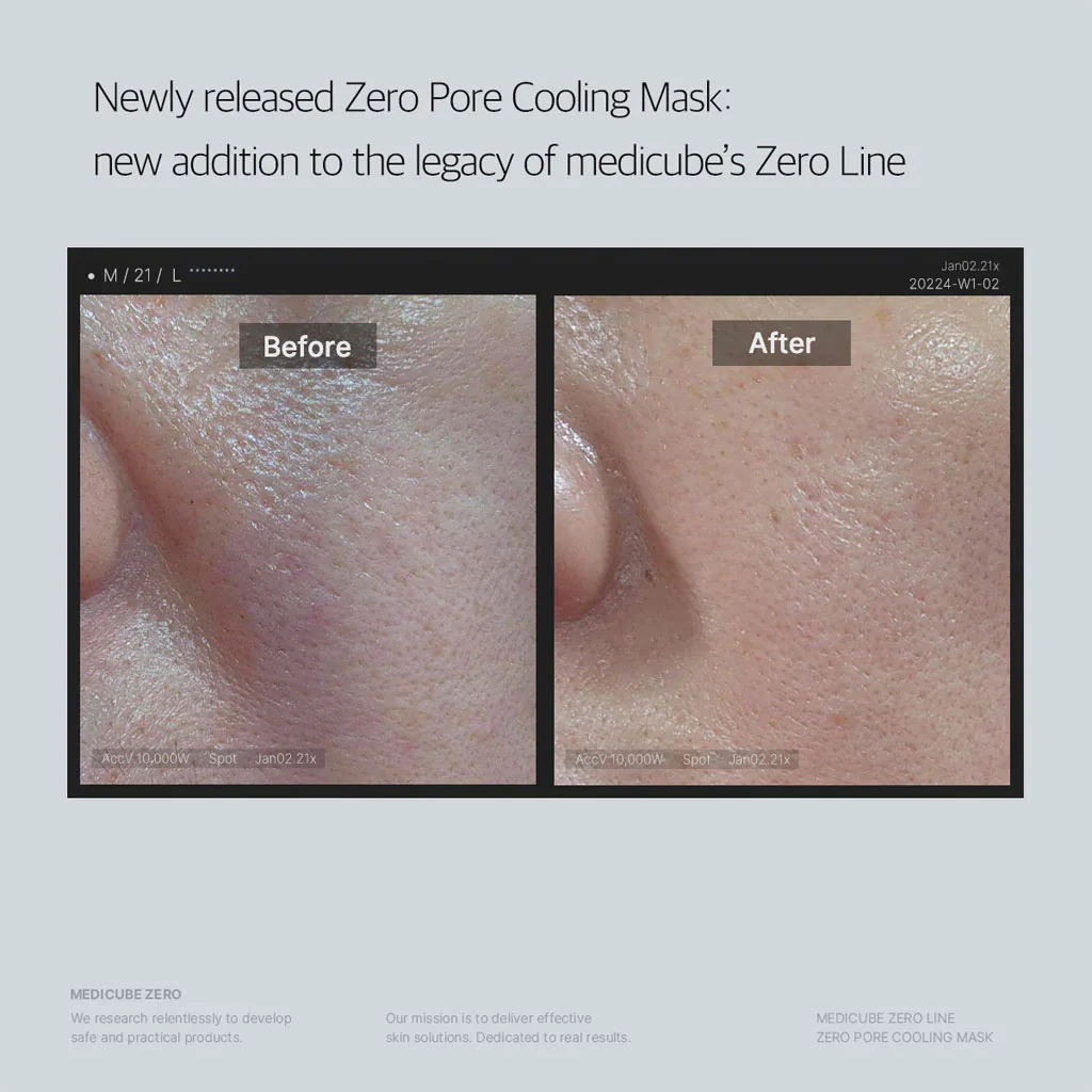 Zero Pore Cooling Mask - Image 2