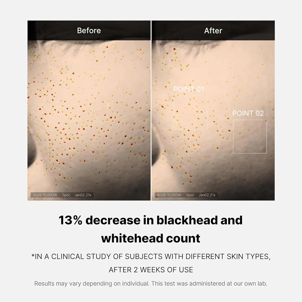 Zero Pore One Day Serum (30ml) - Image 3