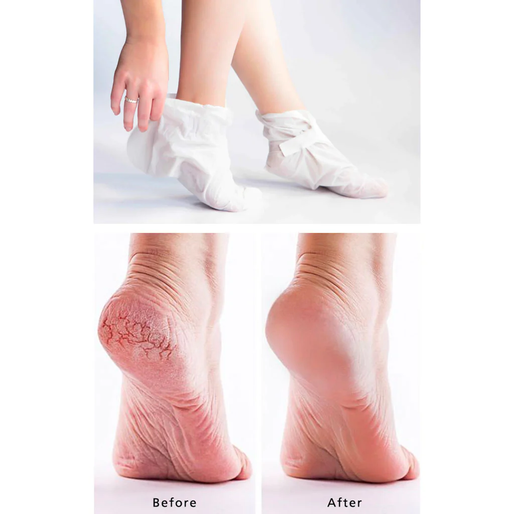 Paraffin Foot Mask - Image 2