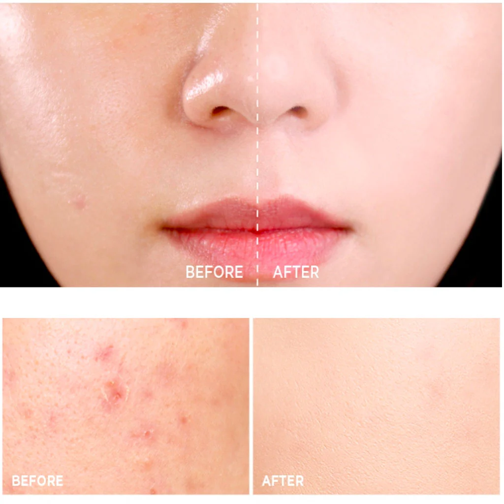 Micro Correctfit Cushion - Image 2