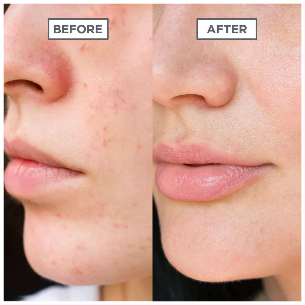 Dermalogy Real Niacinamide 15% Serum - Image 2
