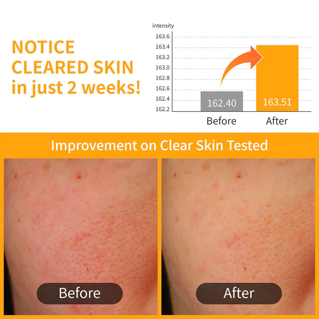 No.3 Radiance Glowing Jumbo Essence Pad (70pcs) - Image 2