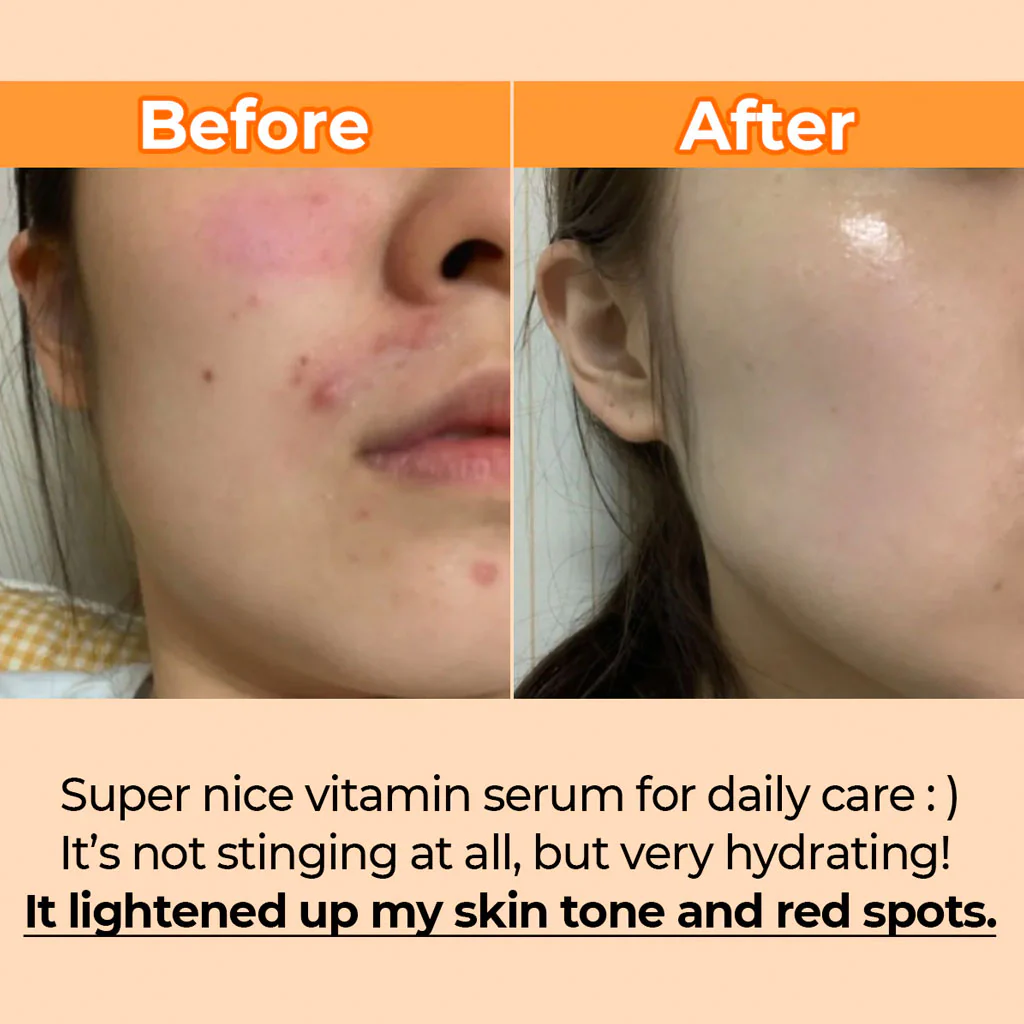 No.5 Goodbye Blemish Serum (50ml) - Image 2
