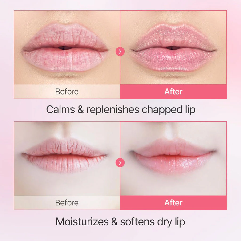 Aura Quartz Lip Mask - Image 3