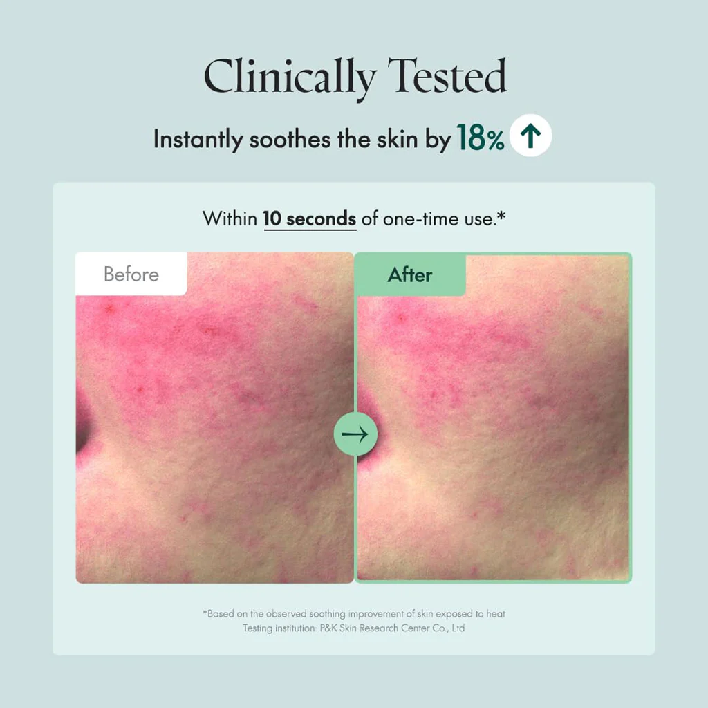 Wonder Releaf Centella Serum - Image 3
