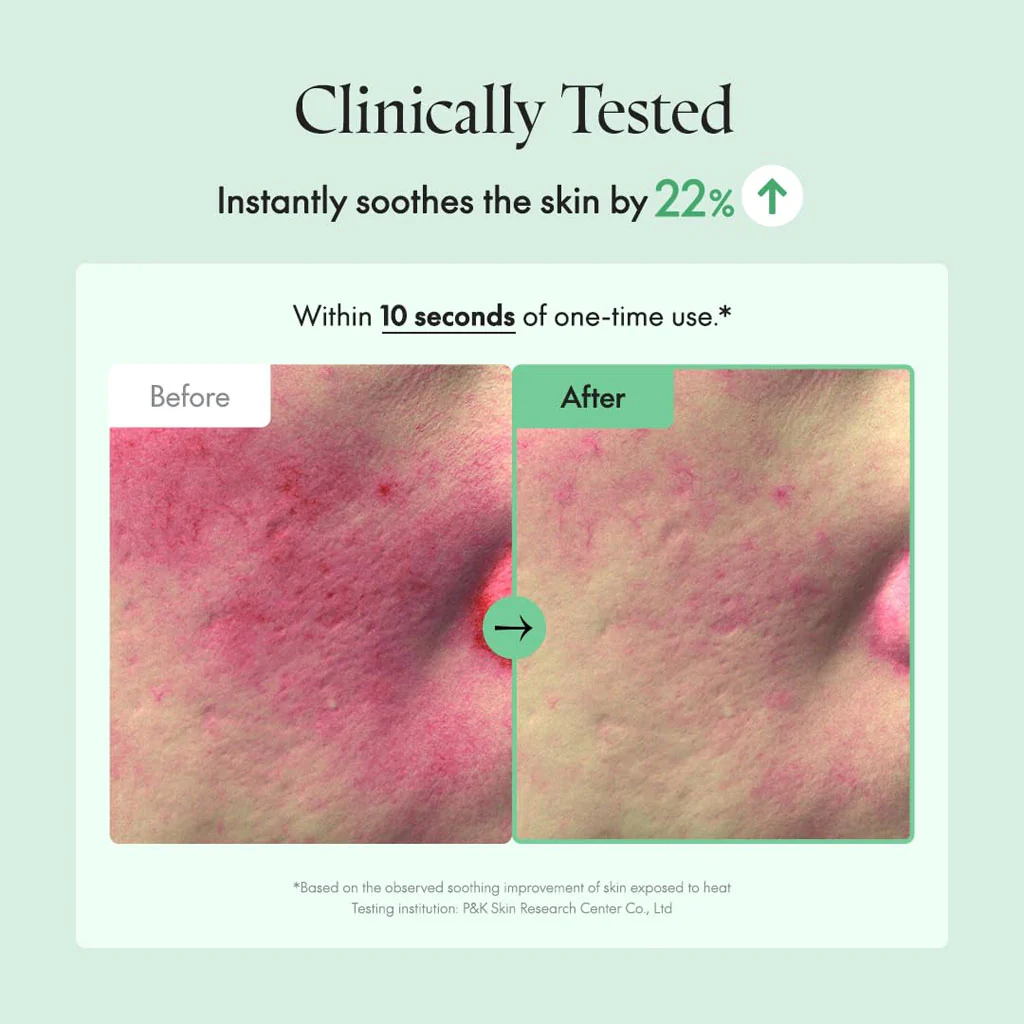 Wonder Releaf Centella Serum Unscented - Image 3