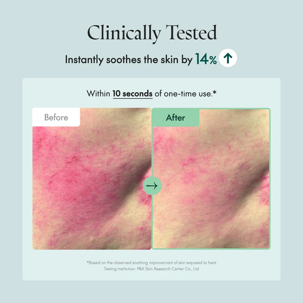 Wonder Releaf Centella Cream - Image 3