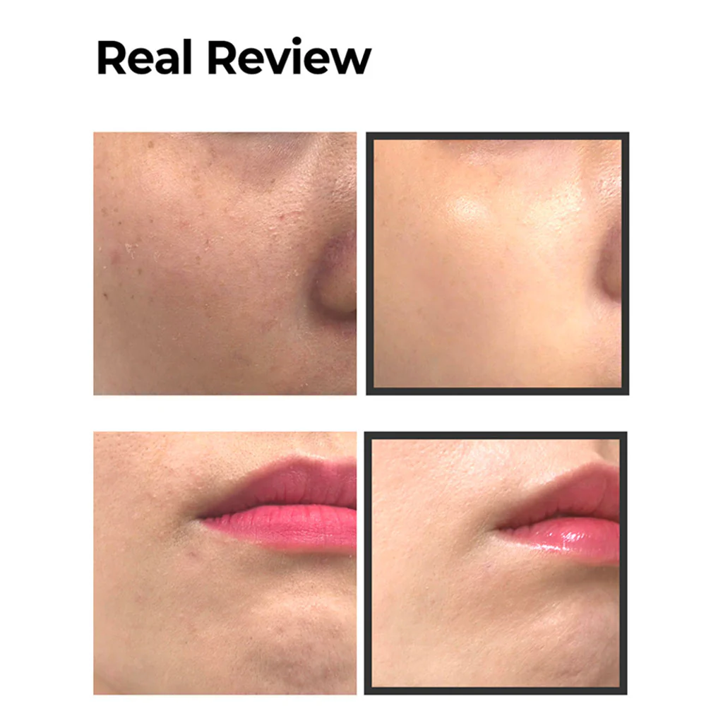 AHA 10% Amino Peeling Ampoule - Image 2