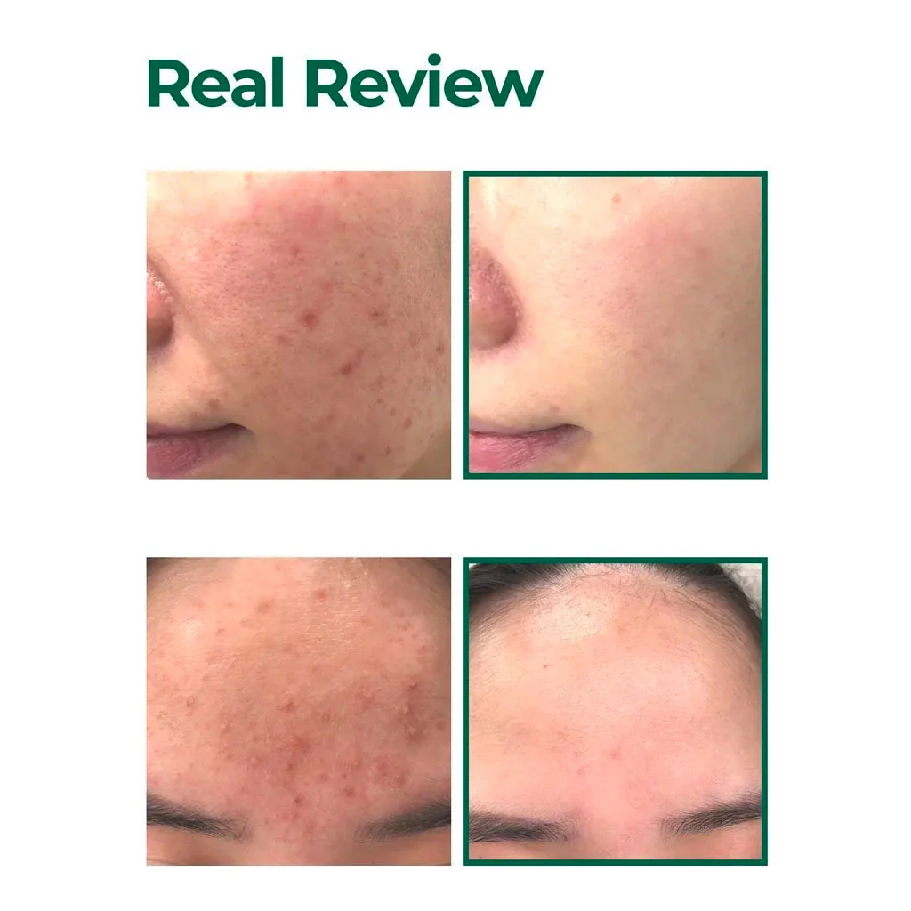 AHA BHA PHA 30 Days Miracle Serum Light - Image 2