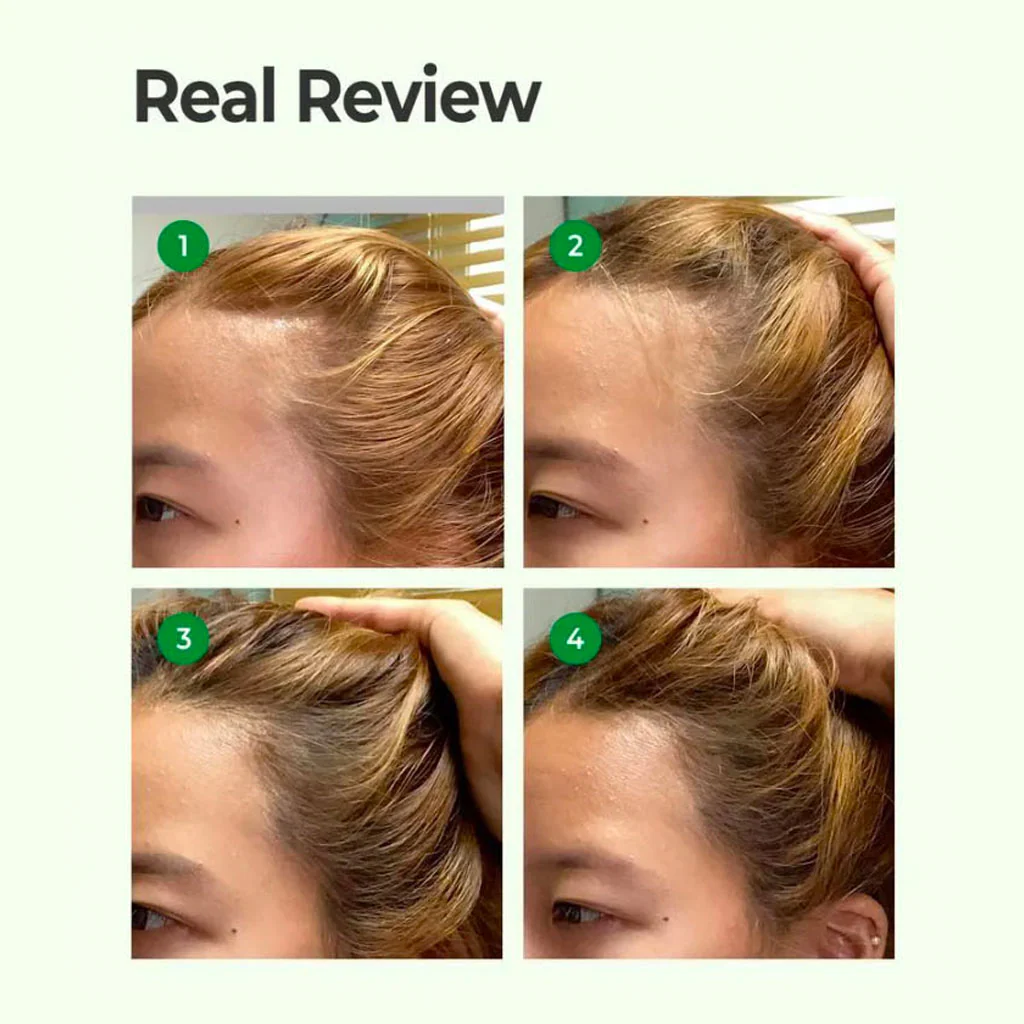Cica Peptide Anti Hair Loss Derma Scalp Shampoo - Image 2