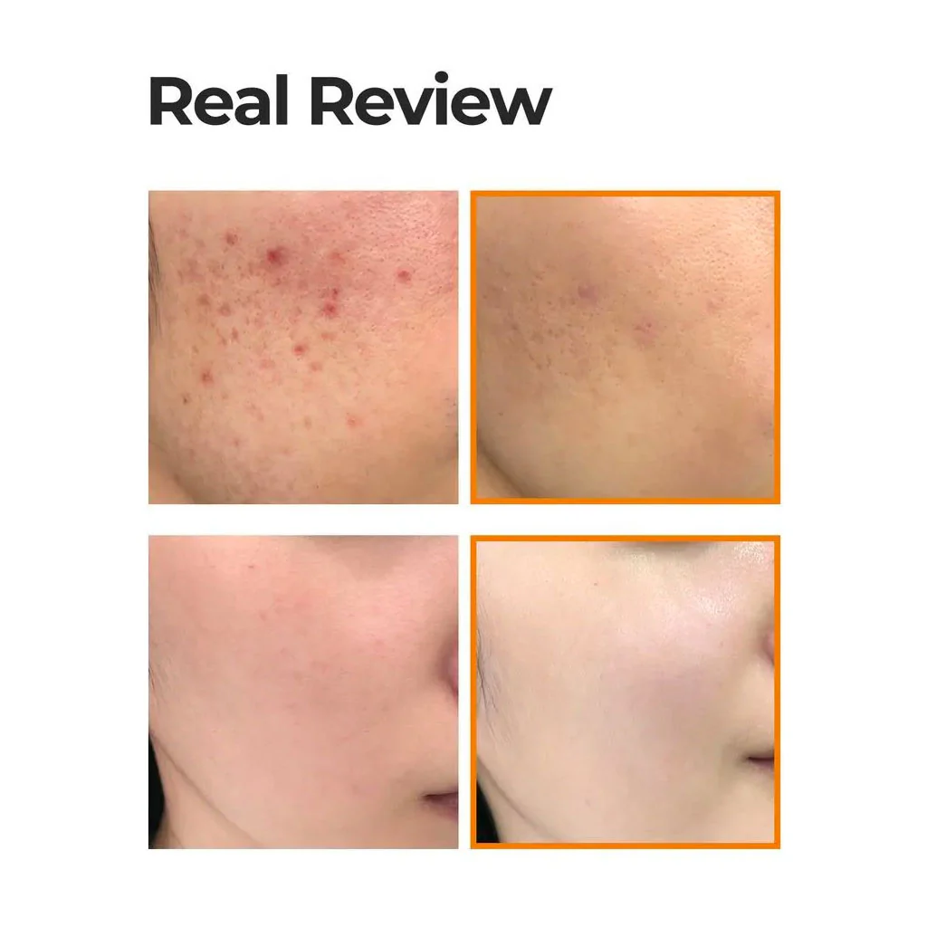 Propolis B5 Glow Barrier Calming Cream - Image 2