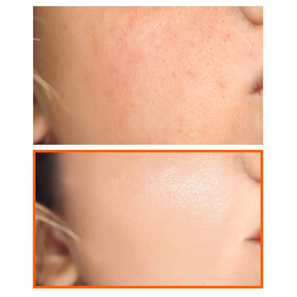 Pure Vitamin C V10 Cleansing Bar - Image 2