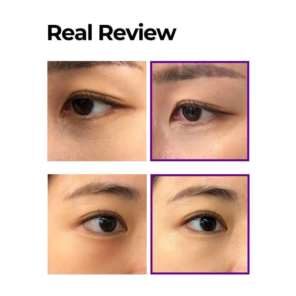 Retinol Intense Advanced Triple Action Eye Cream (30ml) - Image 3